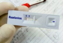 Ειδικός στο χανταϊό προειδοποιεί: «Άσχημο μικρόβιο – Μπορεί να προκαλέσει πολύ γρήγορη επιδείνωση και θάνατο»