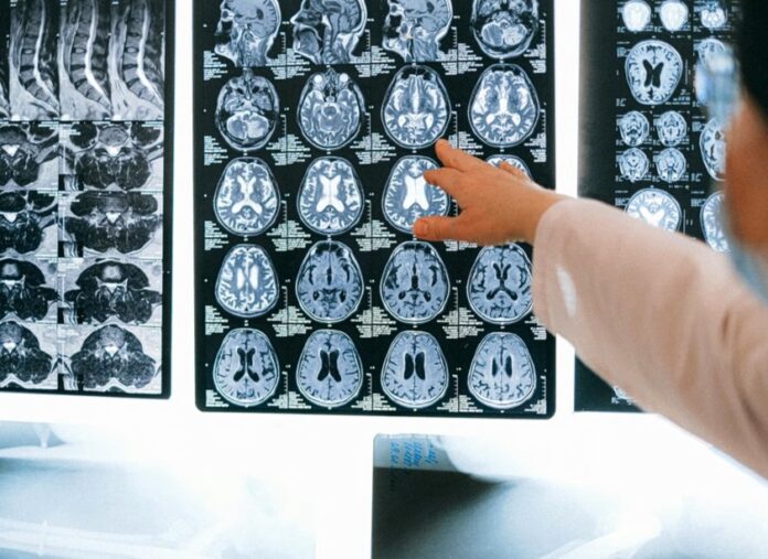 brain-scan-2-1024x683